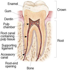rootcanal treatment image 1